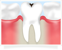 一般歯科（むし歯治療、根管治療）