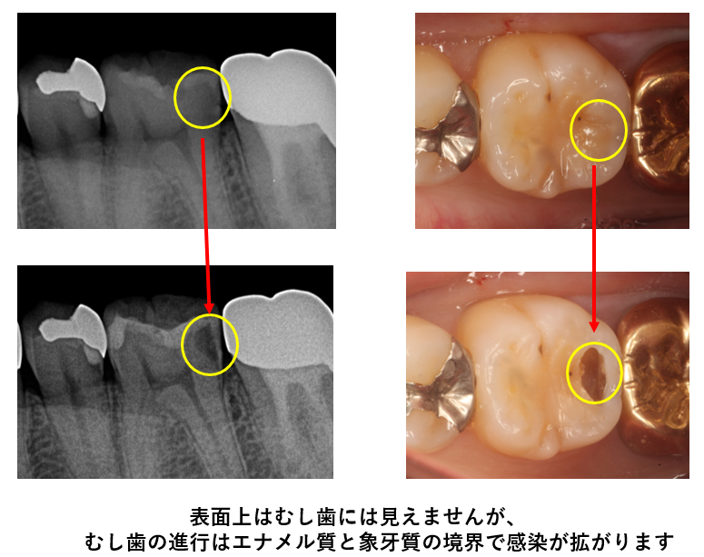 症例2