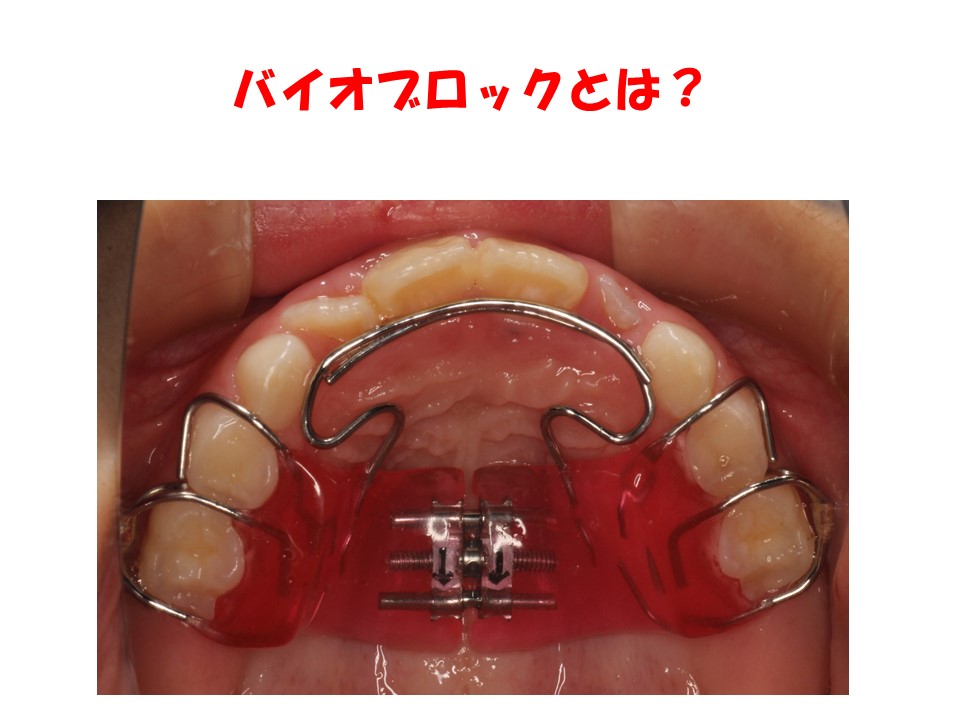 バイオブロックとは？