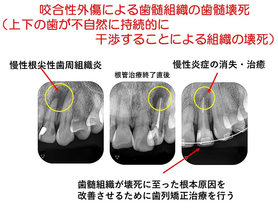 症状が無ければ問題はない？のでしょうか？