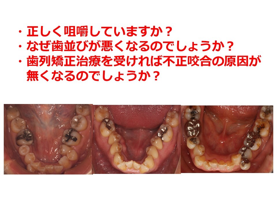 不正咬合の原因は？